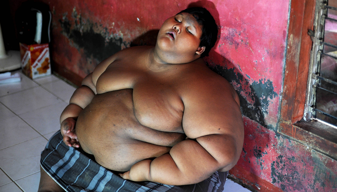world's fattest boy