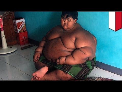 world's fattest boy