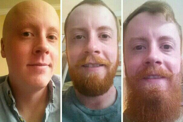 photos which will make you think twice before shaving your beard